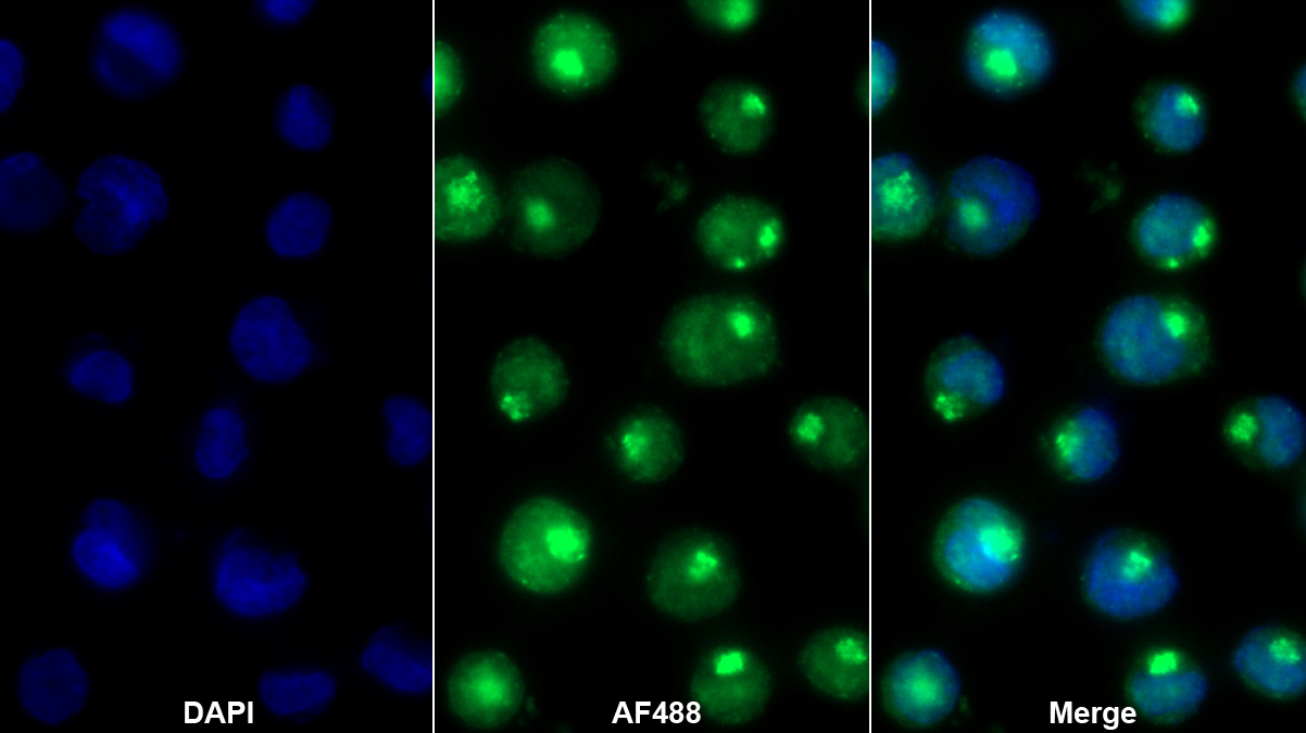 Polyclonal Antibody to Hemoglobin Alpha 1 (HBa1)