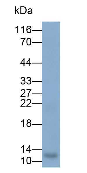 Polyclonal Antibody to Hemoglobin Delta (HBd)