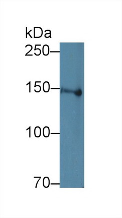 Polyclonal Antibody to Low Density Lipoprotein Receptor Related Protein 8 (LRP8)