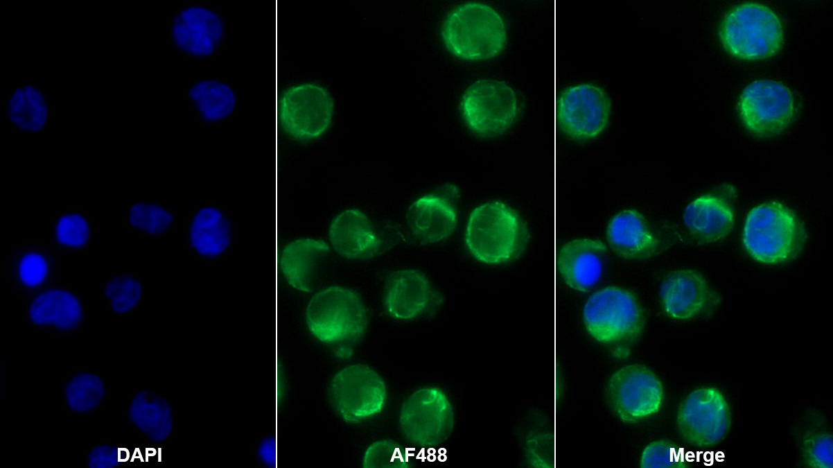 Polyclonal Antibody to Collagen Type VIII Alpha 2 (COL8a2)