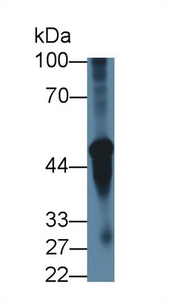 Polyclonal Antibody to Cholinergic Receptor, Nicotinic, Alpha 3 (CHRNa3)