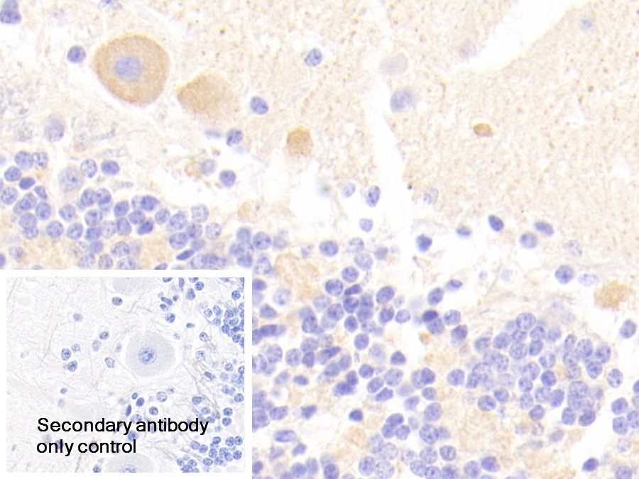 Polyclonal Antibody to Cholinergic Receptor, Nicotinic, Alpha 3 (CHRNa3)