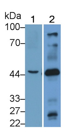 Polyclonal Antibody to Cholinergic Receptor, Nicotinic, Beta 3 (CHRNb3)