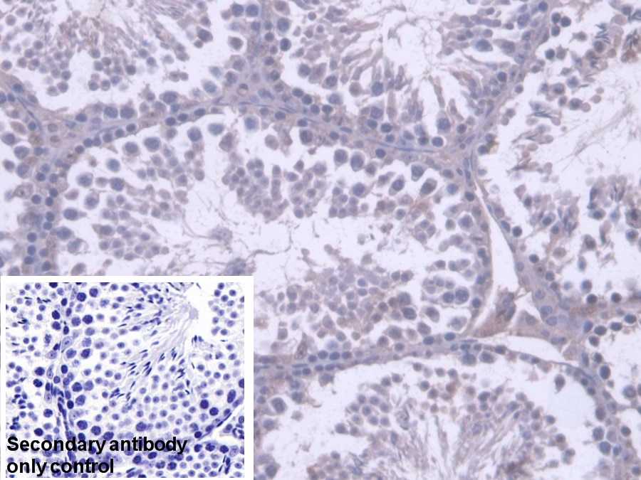 Polyclonal Antibody to Ribonuclease H2 Subunit A (RNASEH2A)