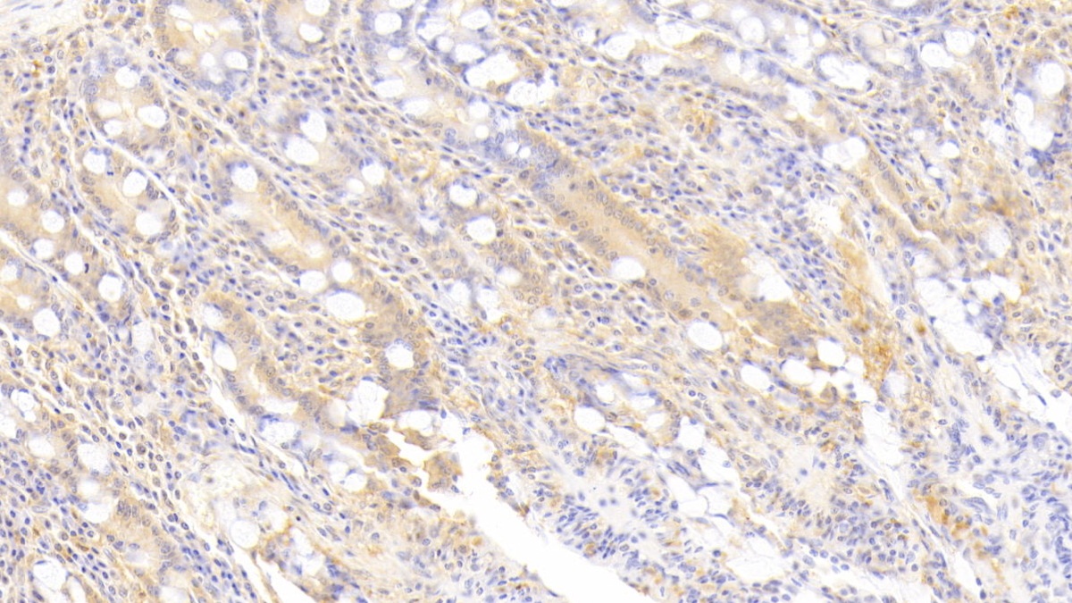 Polyclonal Antibody to Syntenin 2 (ST2)