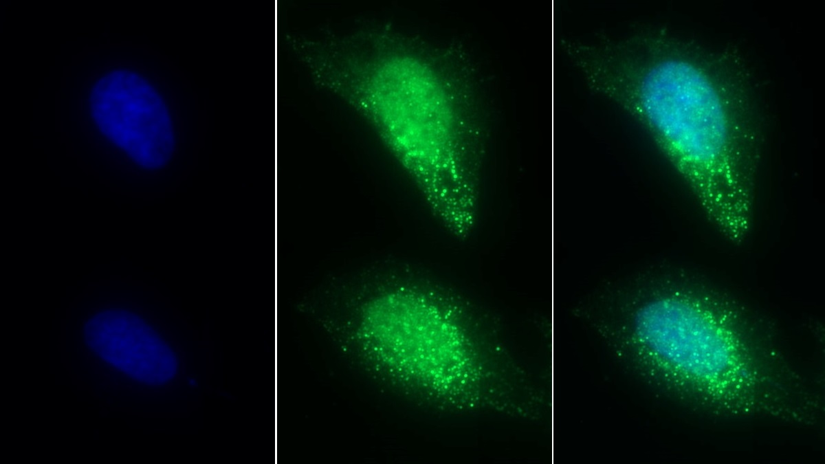 Polyclonal Antibody to Syntenin 2 (ST2)