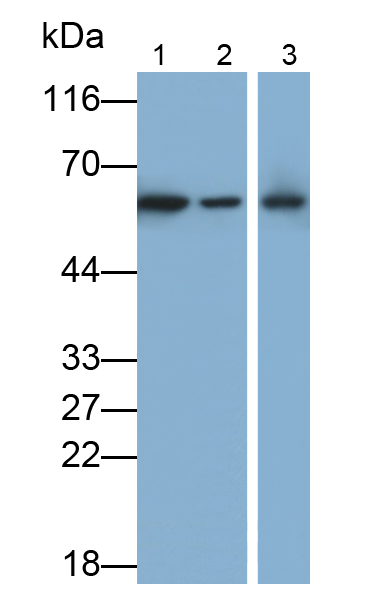 Polyclonal Antibody to Sjogren Syndrome Antigen A2 (SSA2)