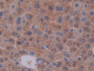 Polyclonal Antibody to Epstein Barr Virus Induced Protein 3 (EBI3)