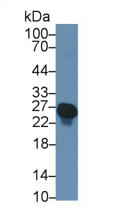 Polyclonal Antibody to Troponin I Type 1, Slow Skeletal (TNNI1)