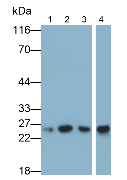 Polyclonal Antibody to Troponin I Type 1, Slow Skeletal (TNNI1)