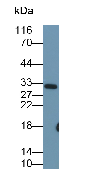 Polyclonal Antibody to Troponin I Type 1, Slow Skeletal (TNNI1)
