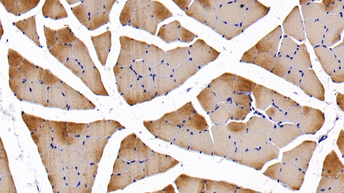 Polyclonal Antibody to Troponin I Type 2, Fast Skeletal (TNNI2)