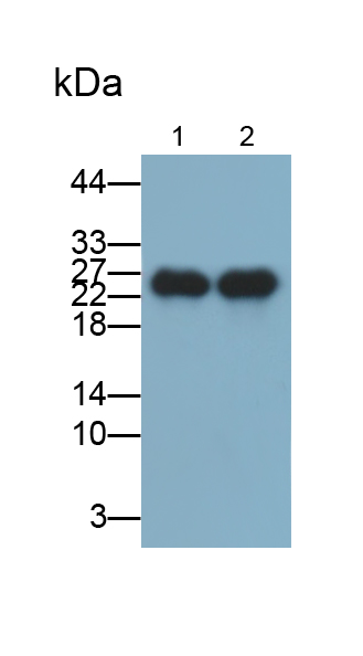 Polyclonal Antibody to Troponin I Type 2, Fast Skeletal (TNNI2)