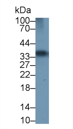 Polyclonal Antibody to Troponin T Type 1, Slow Skeletal (TNNT1)