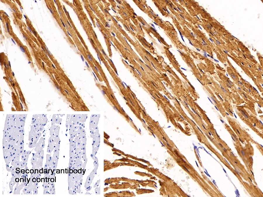 Polyclonal Antibody to Troponin T Type 2, Cardiac (TNNT2)