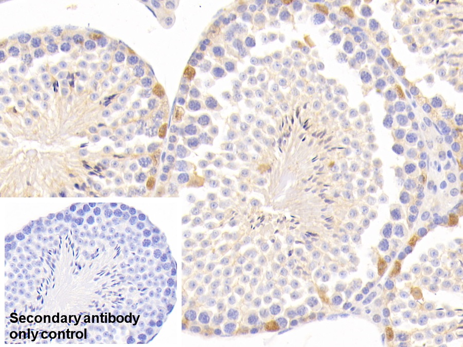 Polyclonal Antibody to Leukotriene A4 Hydrolase (LTA4H)