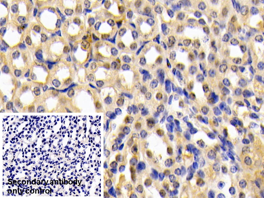 Polyclonal Antibody to Leukotriene A4 Hydrolase (LTA4H)