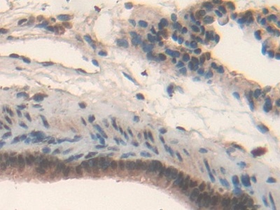 Polyclonal Antibody to Interleukin 17 Receptor D (IL17RD)