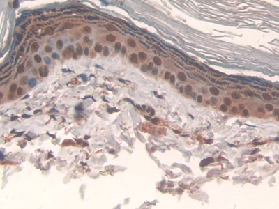 Polyclonal Antibody to Interleukin 17 Receptor D (IL17RD)