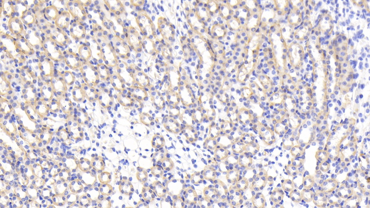 Polyclonal Antibody to Interleukin 17 Receptor B (IL17RB)