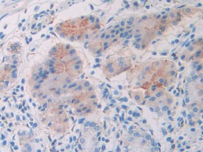 Polyclonal Antibody to Slit Homolog 1 (Slit1)