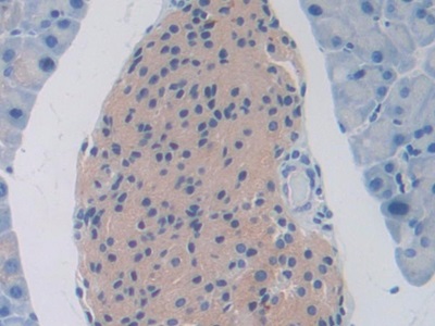 Polyclonal Antibody to Slit Homolog 1 (Slit1)