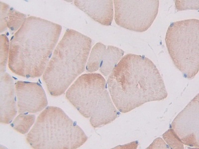 Polyclonal Antibody to Slit Homolog 1 (Slit1)