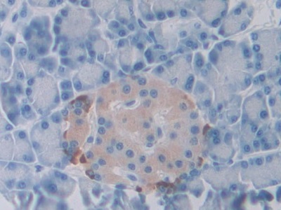Polyclonal Antibody to Slit Homolog 1 (Slit1)