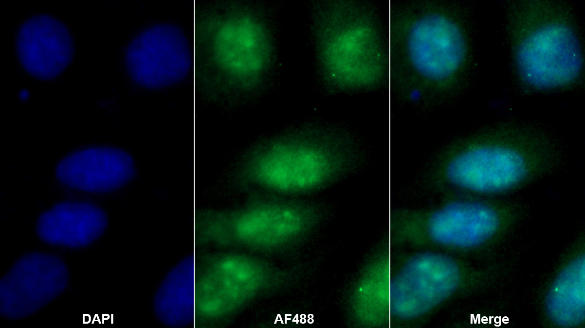 Polyclonal Antibody to Protein Kinase, AMP Activated Gamma 1 (PRKAg1)