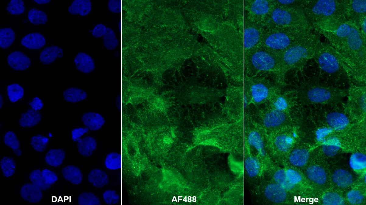 Polyclonal Antibody to Mammary Serine Protease Inhibitor (Maspin)