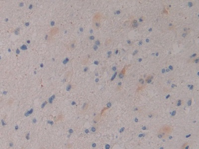 Polyclonal Antibody to Dickkopf Related Protein 3 (DKK3)