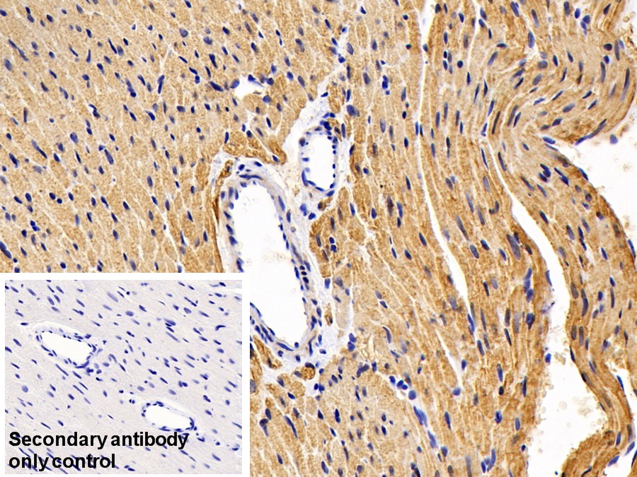 Polyclonal Antibody to Myosin Heavy Chain 6, Cardiac Muscle, Alpha (MYH6)