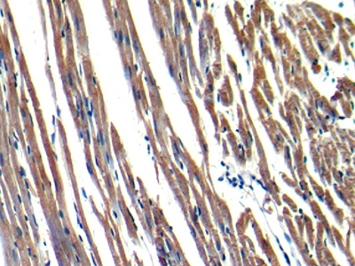 Polyclonal Antibody to Myosin Heavy Chain 6, Cardiac Muscle, Alpha (MYH6)