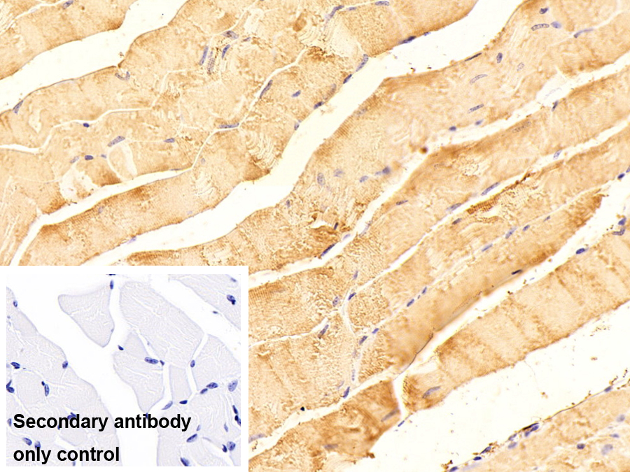 Polyclonal Antibody to Tropomyosin 2 Beta (TPM2)