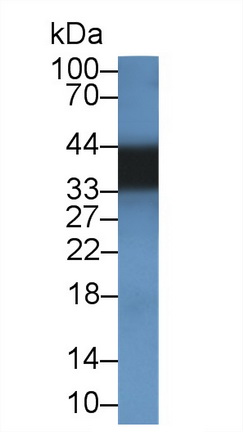 Polyclonal Antibody to Tropomyosin 3 (TPM3)