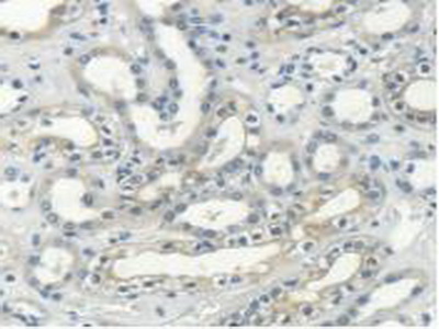 Polyclonal Antibody to Myosin Heavy Chain 14, Non Muscle (MYH14)