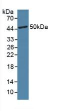 Polyclonal Antibody to Glucagon Like Peptide 1 Receptor (GLP1R)