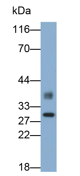 Polyclonal Antibody to Heat Shock 70kDa Binding Protein 1 (HSPBP1)