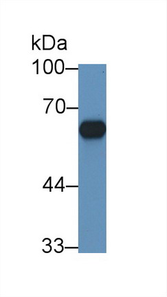 Polyclonal Antibody to Cytochrome P450 11B1 (CYP11B1)