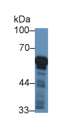 Polyclonal Antibody to Cytochrome P450 11B1 (CYP11B1)