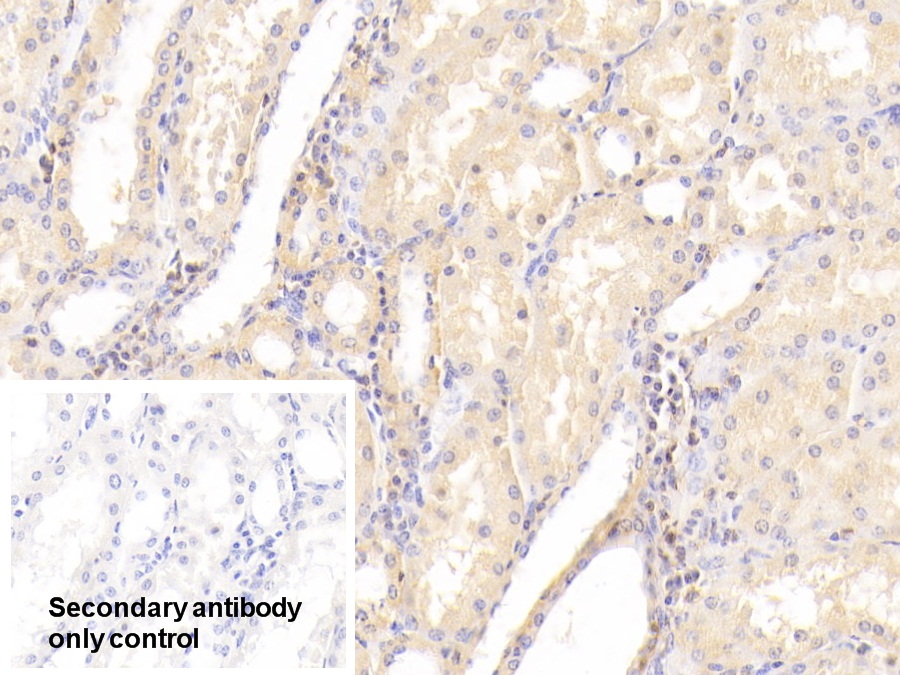 Polyclonal Antibody to Mitogen Activated Protein Kinase Kinase 7 (MAP2K7)