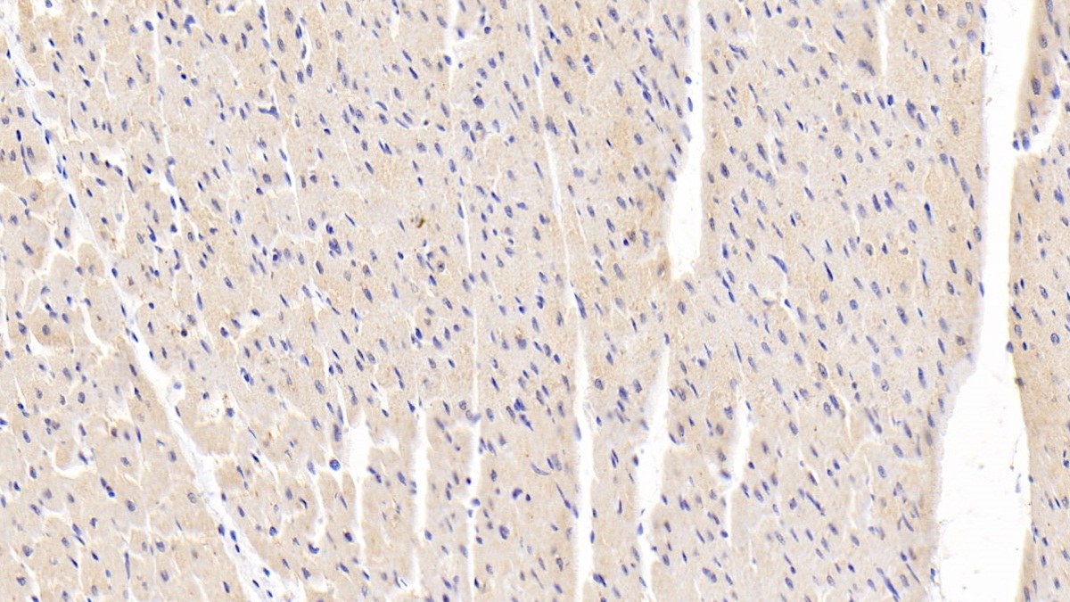 Polyclonal Antibody to Mitogen Activated Protein Kinase 9 (MAPK9)