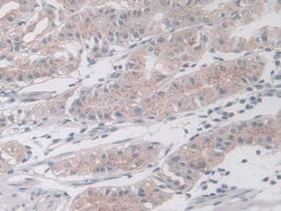 Polyclonal Antibody to Mitogen Activated Protein Kinase 12 (MAPK12)