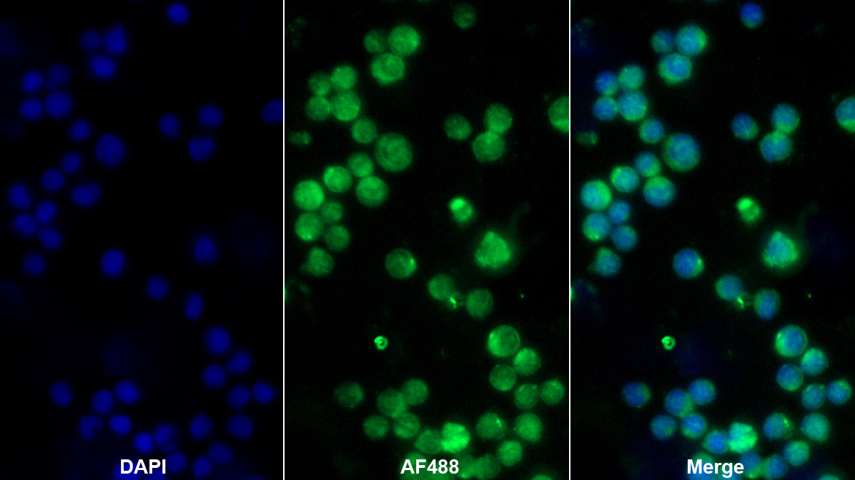 Polyclonal Antibody to Protein Tyrosine Phosphatase, Non Receptor Type 22 (PTPN22)