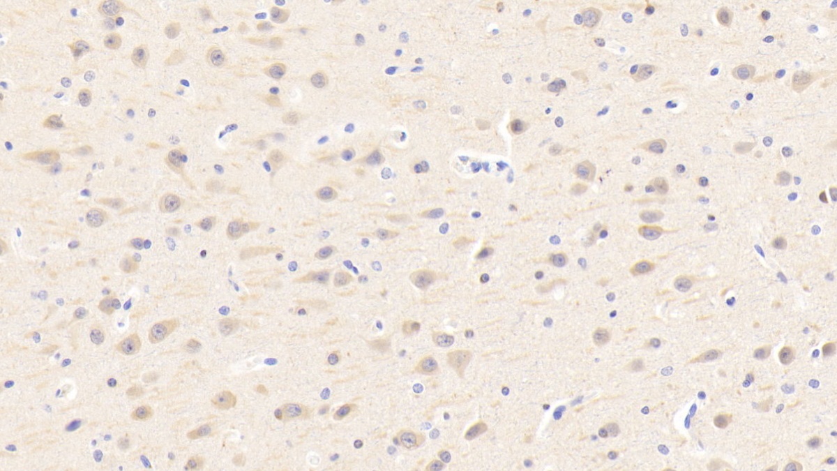 Polyclonal Antibody to Protein Tyrosine Phosphatase Receptor Type A (PTPRA)