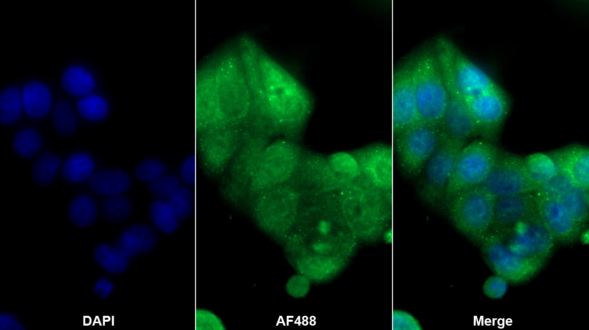 Polyclonal Antibody to ATP Binding Cassette Transporter A3 (ABCA3)