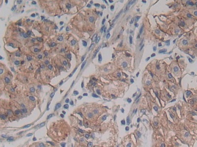 Polyclonal Antibody to ATP Binding Cassette Transporter C4 (ABCC4)