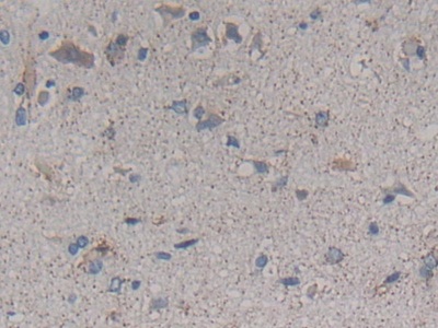 Polyclonal Antibody to ATP Binding Cassette Transporter C4 (ABCC4)