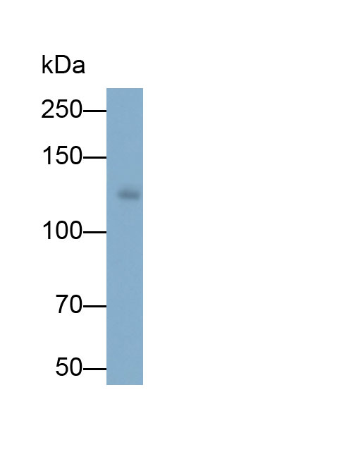 Polyclonal Antibody to ATP Binding Cassette Transporter B4 (ABCB4)