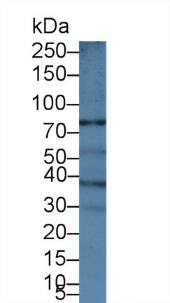 Polyclonal Antibody to ATP Binding Cassette Transporter B5 (ABCB5)